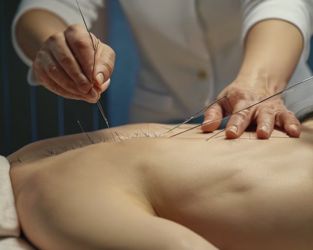 Akupunktőr